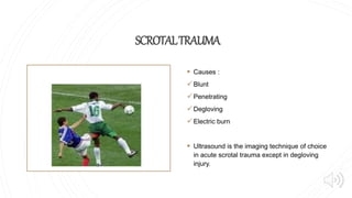 SCROTALTRAUMA
 Causes :
Blunt
Penetrating
Degloving
Electric burn
 Ultrasound is the imaging technique of choice
in acute scrotal trauma except in degloving
injury.
 