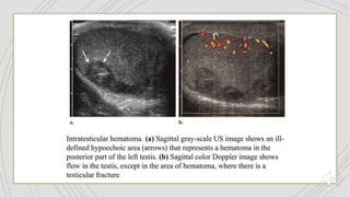 genitourinary trauma.pptx