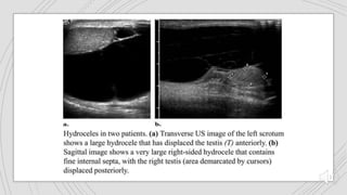 genitourinary trauma.pptx