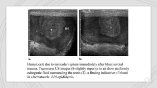genitourinary trauma.pptx