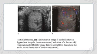 genitourinary trauma.pptx