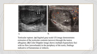 genitourinary trauma.pptx