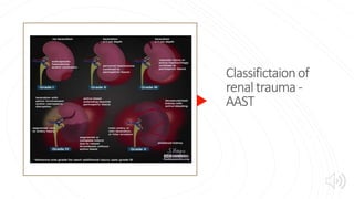 Classifictaionof
renaltrauma-
AAST
 