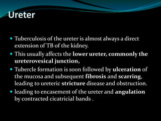 Ureter
 Tuberculosis of the ureter is almost always a direct
extension of TB of the kidney.
 This usually affects the lower ureter, commonly the
ureterovesical junction,
 Tubercle formation is soon followed by ulceration of
the mucosa and subsequent fibrosis and scarring,
leading to ureteric stricture disease and obstruction.
 leading to encasement of the ureter and angulation
by contracted cicatricial bands .
 