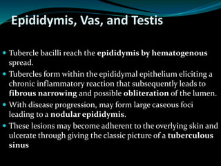Epididymis, Vas, and Testis
 Tubercle bacilli reach the epididymis by hematogenous
spread.
 Tubercles form within the epididymal epithelium eliciting a
chronic inflammatory reaction that subsequently leads to
fibrous narrowing and possible obliteration of the lumen.
 With disease progression, may form large caseous foci
leading to a nodular epididymis.
 These lesions may become adherent to the overlying skin and
ulcerate through giving the classic picture of a tuberculous
sinus
 