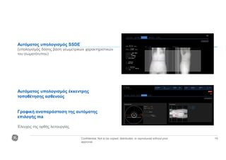 Confidential. Not to be copied, distributed, or reproduced without prior
approval.
19
Αυτόματος υπολογισμός SSDE
(υπολογισμός δόσης βάση γεωμετρικών χαρακτηριστικών
του σωματότυπου)
Αυτόματος υπολογισμός έκκεντρης
τοποθέτησης ασθενούς
Γραφική αναπαράσταση της αυτόματης
επιλογής ma
Έλεγχος της ορθής λειτουργίας
 