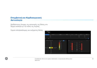 Confidential. Not to be copied, distributed, or reproduced without prior
approval.
20
Επεμβατική και Καρδιοαγγειακή
Ακτινολογία
Δισδιάστατος έλεγχος της κατανομής της δόσης στο
δέρμα ανάλογα με την κλίση της λυχνίας
Σημεία αλληλοκάλυψης και αυξημένης δόσης
 