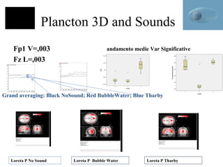 Plancton 3D and Sounds
Fp1 V=,003
Fz L=,003

andamento medie Var Significative

Grand averaging: Black NoSound; Red BubbleWater; Blue Tharby

Loreta P No Sound

Loreta P Bubble Water

Loreta P Tharby

 