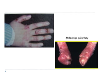 Genodermatoses.pptx
