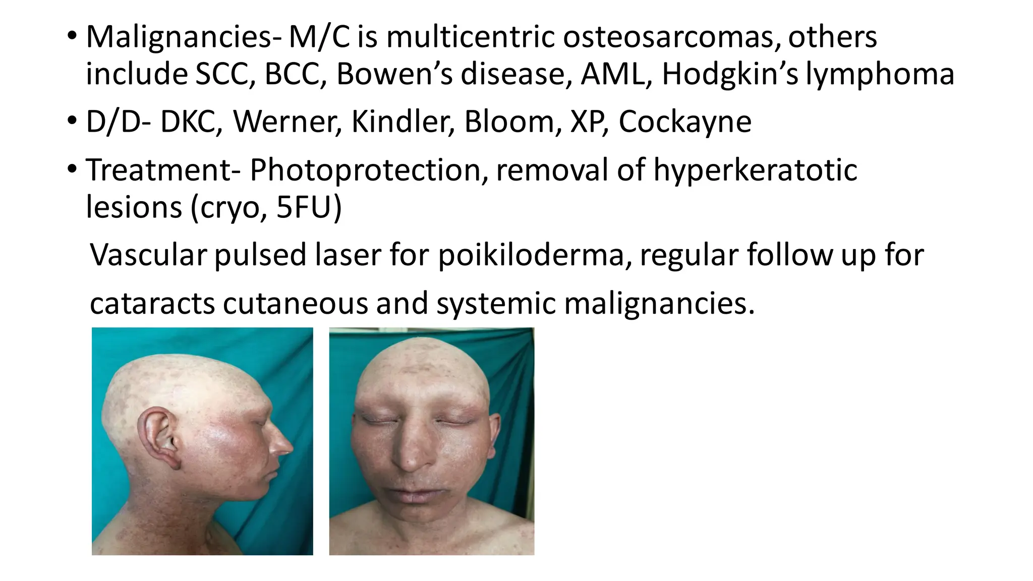• Malignancies- M/C is multicentric osteosarcomas,others
include SCC, BCC, Bowen’s disease, AML, Hodgkin’s lymphoma
• D/D- DKC, Werner, Kindler, Bloom, XP, Cockayne
• Treatment- Photoprotection, removal of hyperkeratotic
lesions (cryo, 5FU)
Vascular pulsed laser for poikiloderma, regular follow up for
cataracts cutaneous and systemic malignancies.
 