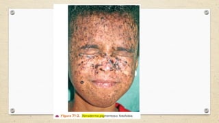 Genodermatosis Genodermatosis .pptxxxxxxxxxxxxxxxxxxxxx | PPTX