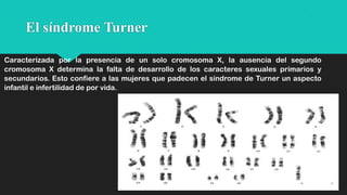 El síndrome Turner
Caracterizada por la presencia de un solo cromosoma X, la ausencia del segundo
cromosoma X determina la falta de desarrollo de los caracteres sexuales primarios y
secundarios. Esto confiere a las mujeres que padecen el síndrome de Turner un aspecto
infantil e infertilidad de por vida.

 