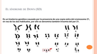 EL SÍNDROME DE DOWN (SD)
Es un trastorno genético causado por la presencia de una copia extra del cromosoma 21,
en vez de los dos habituales, por ello se denomina también trisomía del par 21.

 