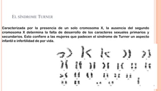 EL SÍNDROME TURNER
Caracterizada por la presencia de un solo cromosoma X, la ausencia del segundo
cromosoma X determina la falta de desarrollo de los caracteres sexuales primarios y
secundarios. Esto confiere a las mujeres que padecen el síndrome de Turner un aspecto
infantil e infertilidad de por vida.

 