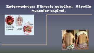 Enfermedades: Fibrosis quística, Atrofia
muscular espinal.

 