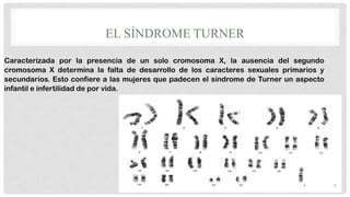 EL SÍNDROME TURNER
Caracterizada por la presencia de un solo cromosoma X, la ausencia del segundo
cromosoma X determina la falta de desarrollo de los caracteres sexuales primarios y
secundarios. Esto confiere a las mujeres que padecen el síndrome de Turner un aspecto
infantil e infertilidad de por vida.

 
