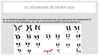EL SÍNDROME DE DOWN (SD)
Es un trastorno genético causado por la presencia de una copia extra del cromosoma 21,
en vez de los dos habituales, por ello se denomina también trisomía del par 21.

 