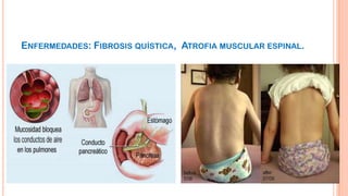 ENFERMEDADES: FIBROSIS QUÍSTICA, ATROFIA MUSCULAR ESPINAL.

 