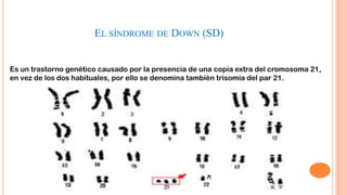 EL SÍNDROME DE DOWN (SD)
Es un trastorno genético causado por la presencia de una copia extra del cromosoma 21,
en vez de los dos habituales, por ello se denomina también trisomía del par 21.

 