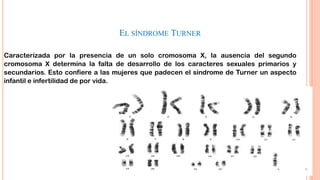 EL SÍNDROME TURNER
Caracterizada por la presencia de un solo cromosoma X, la ausencia del segundo
cromosoma X determina la falta de desarrollo de los caracteres sexuales primarios y
secundarios. Esto confiere a las mujeres que padecen el síndrome de Turner un aspecto
infantil e infertilidad de por vida.

 