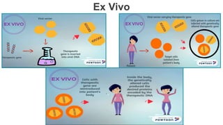 Ex Vivo
 