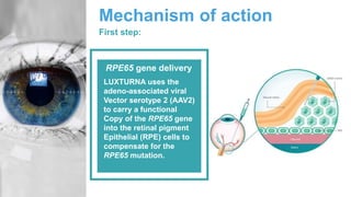 Mechanism of action
First step:
LUXTURNA uses the
adeno-associated viral
Vector serotype 2 (AAV2)
to carry a functional
Copy of the RPE65 gene
into the retinal pigment
Epithelial (RPE) cells to
compensate for the
RPE65 mutation.
RPE65 gene delivery
 