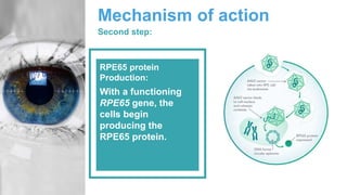 Mechanism of action
Second step:
With a functioning
RPE65 gene, the
cells begin
producing the
RPE65 protein.
RPE65 protein
Production:
 