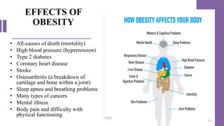 EFFECTS OF
OBESITY
• All-causes of death (mortality)
• High blood pressure (hypertension)
• Type 2 diabetes
• Coronary heart disease
• Stroke
• Osteoarthritis (a breakdown of
cartilage and bone within a joint)
• Sleep apnea and breathing problems
• Many types of cancers
• Mental illness
• Body pain and difficulty with
physical functioning
21
 