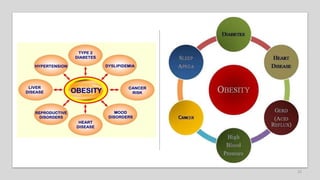 genetics and obesity