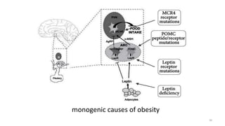 monogenic causes of obesity
39
 