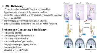 POMC Deficiency
• Pro-opiomelanocortin (POMC) is produced by
hypothalamic neurons of the arcuate nucleus
• presented in neonatal life with adrenal crisis due to isolated
ACTH deficiency
• hyperphagic, developing early-onset obesity
• pale skin and red hair due to the lack of MSH function
Prohormone Convertase 1 Deficiency
• childhood obesity
• abnormal glucose homeostasis
• very low plasma insulin
• elevated levels of pro insulin
• hypogonadotropic hypogonadism
• hypocortisolemia
• elevated levels of POMC 42
 
