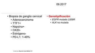 • Biopsia de ganglio cervical
• Adenocarcinoma
• TTF1+
• Napsina+
• CK20-
• Estrógeno-
• PD-L1: 1-49%
Creado por Mauricio Lema Medina MD
• Genotipificación
• EGFR mutado L858R
• ALK no mutado
09.2017
 