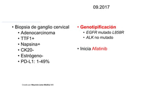 • Biopsia de ganglio cervical
• Adenocarcinoma
• TTF1+
• Napsina+
• CK20-
• Estrógeno-
• PD-L1: 1-49%
Creado por Mauricio Lema Medina MD
• Genotipificación
• EGFR mutado L858R
• ALK no mutado
• Inicia Afatinib
09.2017
 
