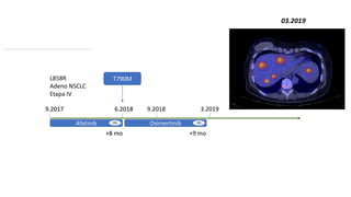 L858R
Adeno NSCLC
Etapa IV
Afatinib
T790M
9.2017 6.2018
PD
+8 mo
Afatinib Osimertinib
T790M
9.2017 6.2018 9.2018 3.2019
PD PD
+8 mo +9 mo
03.2019
 
