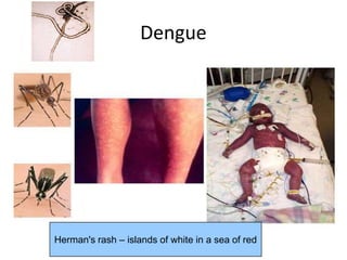 Herman S Rash Gen pathology finals pictures | PPTX