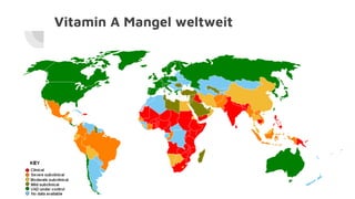 Vitamin A Mangel weltweit
 