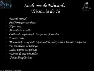 Síndrome de Edwards  Trissomia do 18 Retardo mental Mal formações cardíacas Hipertonia Mandíbula retraída Orelhas de implantação baixa e mal formadas Esterno curto Mão cerrada – segundo e quinto dedo sobrepondo o terceiro e o quarto Pés em cadeira de balanço Sulcos únicos nas palmas Padrões de arco nos dedos Unhas hipoplásticas Grupo Aliança de Enfermagem 