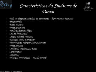 Características da Síndrome de Down Pode ser diagnosticada logo ao nascimento – hipotonia nos neonatos Braquicefalia Baixa estatura Prega epicântica Fenda palpebral oblíqua Céu da boca ogival Língua sulcada e saliente Dentição tardia e irregular Pescoço curto e largo5º dedo encurvado Prega simiesca Orelhas de implantação baixa  Cardiopatias Leucemias Principal preocupação – retardo mental Grupo Aliança de Enfermagem 
