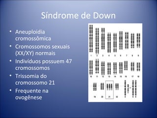 Síndrome de Down Aneuploidia cromossômica Cromossomos sexuais (XX/XY) normais Indivíduos possuem 47 cromossomos Trissomia do cromossomo 21 Frequente na ovogênese 