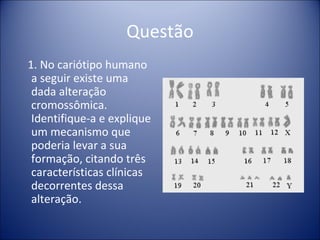 Questão 1. No cariótipo humano a seguir existe uma dada alteração cromossômica. Identifique-a e explique um mecanismo que poderia levar a sua formação, citando três características clínicas decorrentes dessa alteração. 