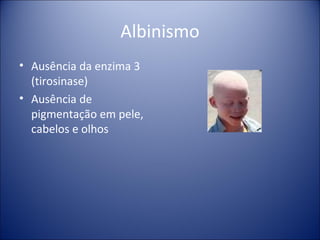 Albinismo Ausência da enzima 3 (tirosinase) Ausência de pigmentação em pele, cabelos e olhos 