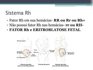 Sistema Rh
• Fator Rh em sua hemácias- RR ou Rr ou Rh+
• Não possui fator Rh nas hemácias- rr ou RH-
• FATOR Rh e ERITROBLATOSE FETAL
 
