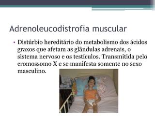Adrenoleucodistrofia muscular
• Distúrbio hereditário do metabolismo dos ácidos
  graxos que afetam as glândulas adrenais, o
  sistema nervoso e os testículos. Transmitida pelo
  cromossomo X e se manifesta somente no sexo
  masculino.
 