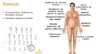 Doenças
 Cromossômicas: Síndrome de
Klinefelter, de Down
 Genéticas: Diabete e hemofilia
 