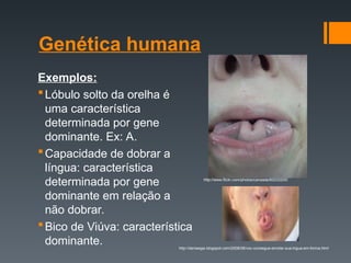 Genética humana
Exemplos:
Lóbulo solto da orelha é
uma característica
determinada por gene
dominante. Ex: A.
Capacidade de dobrar a
língua: característica
determinada por gene
dominante em relação a
não dobrar.
Bico de Viúva: característica
dominante.
http://www.flickr.com/photos/cansada/60233200/
http://denisegw.blogspot.com/2008/08/voc-consegue-enrolar-sua-lngua-em-forma.html
 