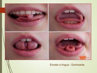 Enrolar a língua - Dominante
 