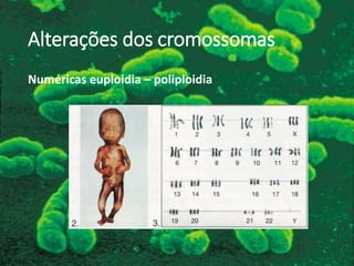 Alterações dos cromossomas
Numéricas euploidia – poliploidia
 