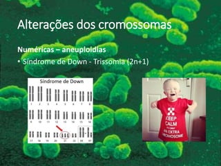 Alterações dos cromossomas
Numéricas – aneuploidias
• Síndrome de Down - Trissomia (2n+1)
 