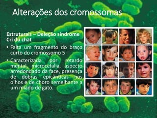 Alterações dos cromossomas
Estruturais – Deleção síndrome
Cri du chat
• Falta um fragmento do braço
curto do cromossomo 5
• Caracterizada por retardo
mental, microcefalia, aspecto
arredondado da face, presença
de dobras epicânticas nos
olhos e de choro semelhante a
um miado de gato.
 