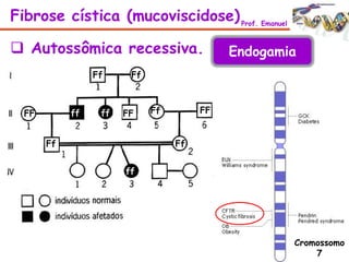 Fibrose cística (mucoviscidose)Prof. Emanuel
 Autossômica recessiva.
Cromossomo
7
Ff Ff
ff ffFF
Ff Ff
FFFF Ff
ff
Endogamia
 